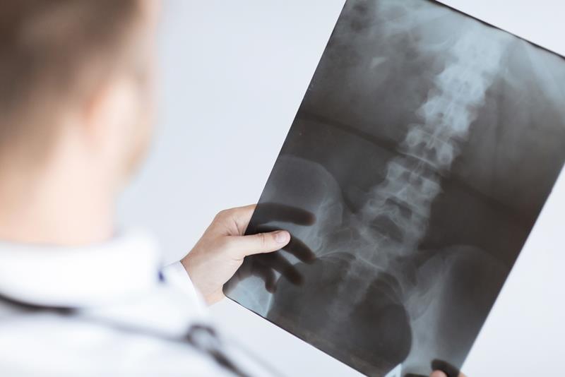 X-Rays Fort Mill, SC
